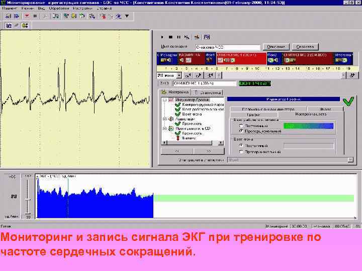 Мониторинг и запись сигнала ЭКГ при тренировке по частоте сердечных сокращений. 