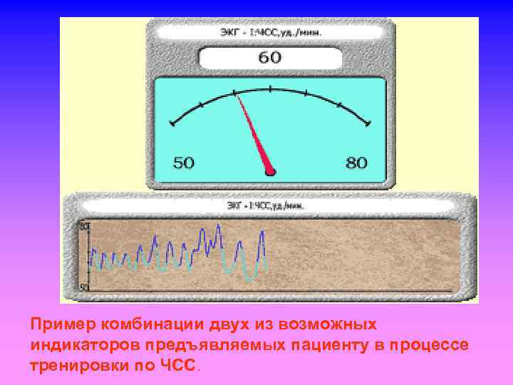 Пример комбинации двух из возможных индикаторов предъявляемых пациенту в процессе тренировки по ЧСС. 