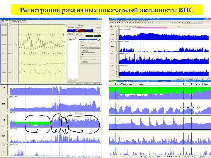 Регистрация различных показателей активности ВНС 