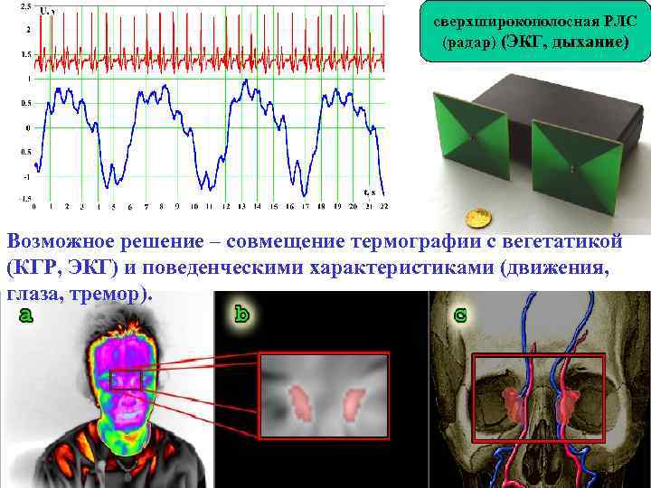 сверхширокополосная РЛС (радар) (ЭКГ, дыхание) Возможное решение – совмещение термографии с вегетатикой (КГР, ЭКГ)