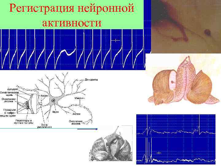 Регистрация нейронной активности 