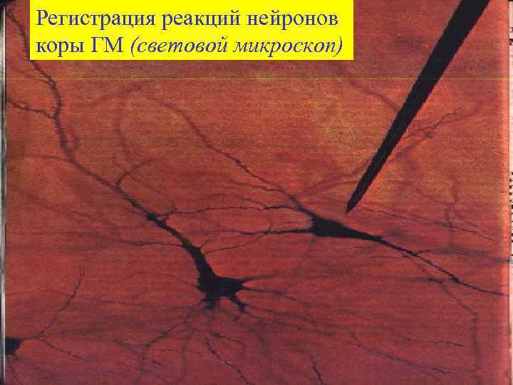Регистрация реакций нейронов коры ГМ (световой микроскоп) 