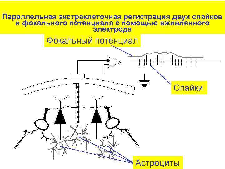 Параллельная экстраклеточная регистрация двух спайков и фокального потенциала с помощью вживленного электрода Фокальный потенциал