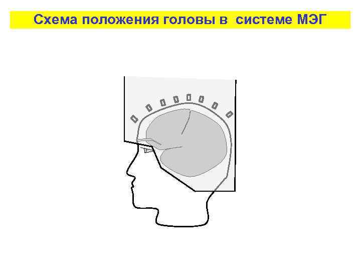 Схема положения головы в системе МЭГ 