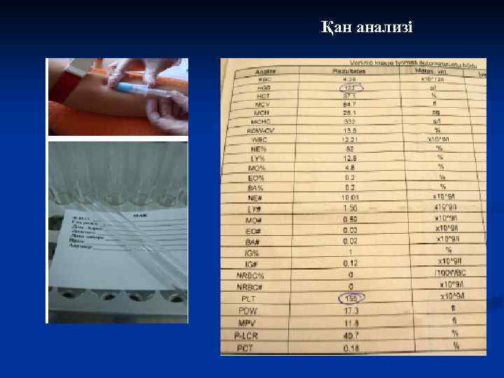 Қан анализі 