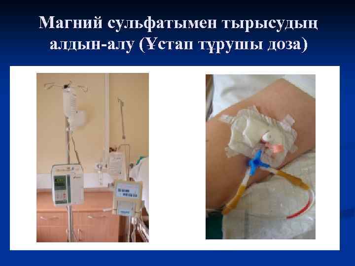 Магний сульфатымен тырысудың алдын-алу (Ұстап тұрушы доза) 