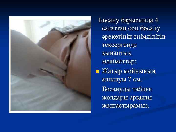 Босану барысында 4 сағаттан соң босану әрекетінің тиімділігін тексергенде қынаптық мәліметтер: n Жатыр мойнының
