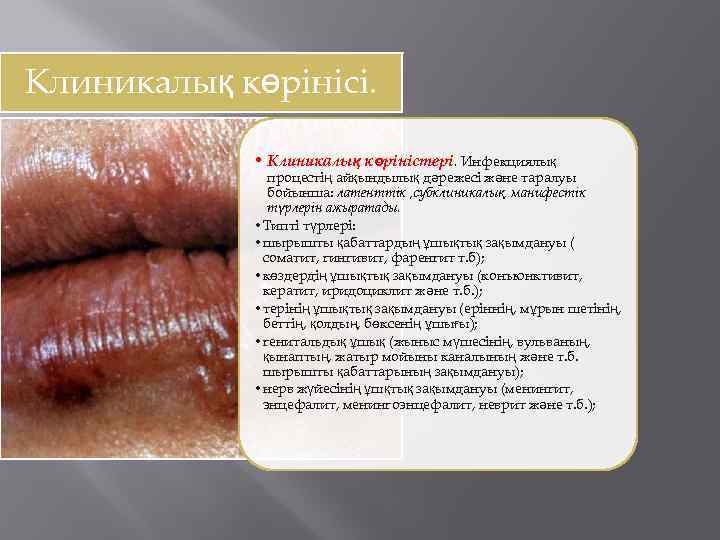 Клиникалық көрінісі. • Клиникалық көріністері. Инфекциялық процестің айқындылық дәрежесі және таралуы бойынша: латенттік ,