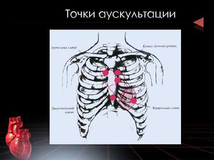 Точки аускультации 