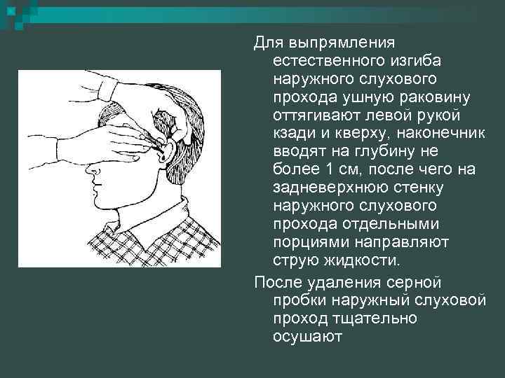 Уход за наружным слуховым проходом. Оттянуть ушную раковину кзади и кверху.