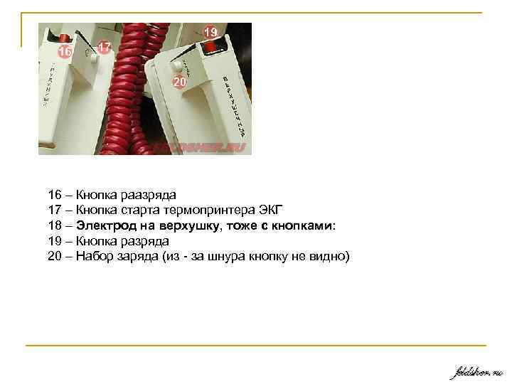 16 – Кнопка раазряда 17 – Кнопка старта термопринтера ЭКГ 18 – Электрод на