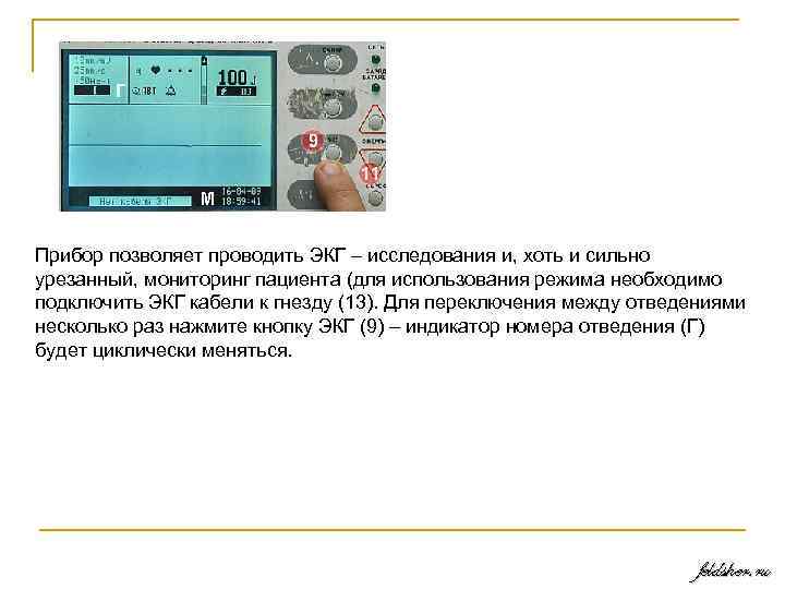 Прибор позволяет проводить ЭКГ – исследования и, хоть и сильно урезанный, мониторинг пациента (для