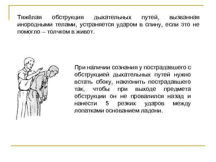 Тяжёлая обструкция дыхательных путей, вызванная инородными телами, устраняется ударом в спину, если это не