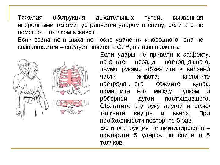 Тяжёлая обструкция дыхательных путей, вызванная инородными телами, устраняется ударом в спину, если это не