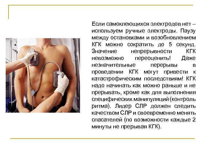 Если самоклеющихся электродов нет – используем ручные электроды. Паузу между остановками и возобновлением КГК
