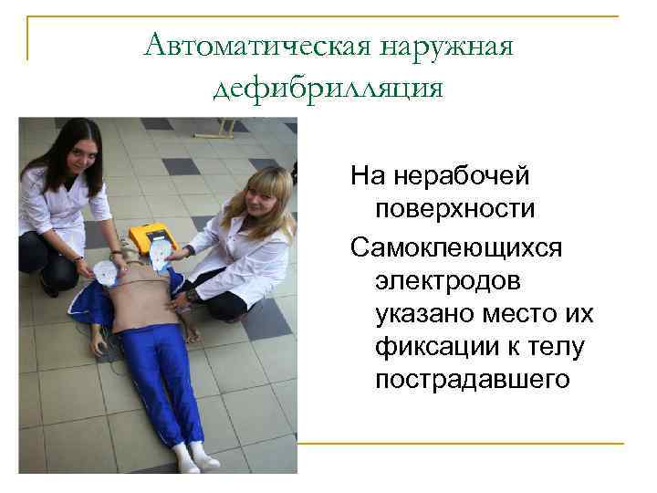 Автоматическая наружная дефибрилляция На нерабочей поверхности Самоклеющихся электродов указано место их фиксации к телу