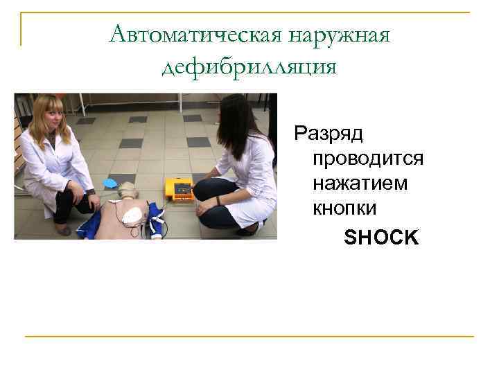 Автоматическая наружная дефибрилляция Разряд проводится нажатием кнопки SHOCK 