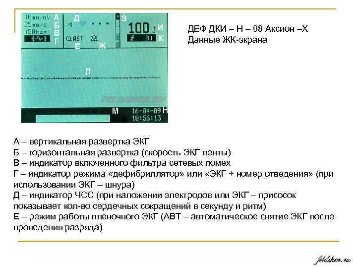 ДЕФ ДКИ – Н – 08 Аксион –Х Данные ЖК экрана А – вертикальная