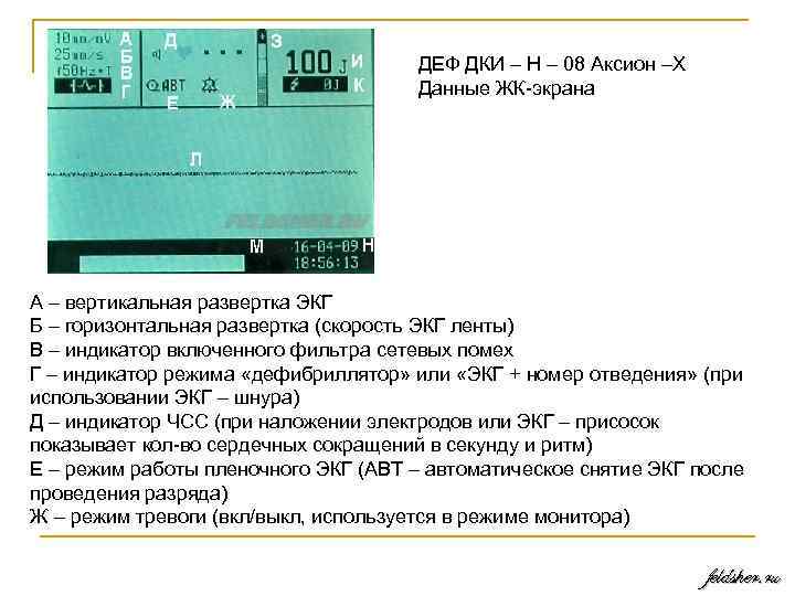 ДЕФ ДКИ – Н – 08 Аксион –Х Данные ЖК экрана А – вертикальная