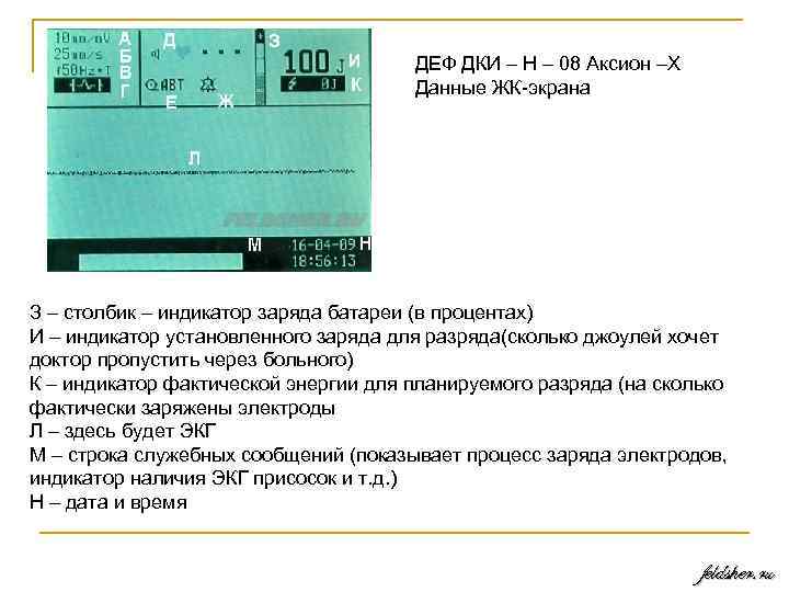 ДЕФ ДКИ – Н – 08 Аксион –Х Данные ЖК экрана З – столбик