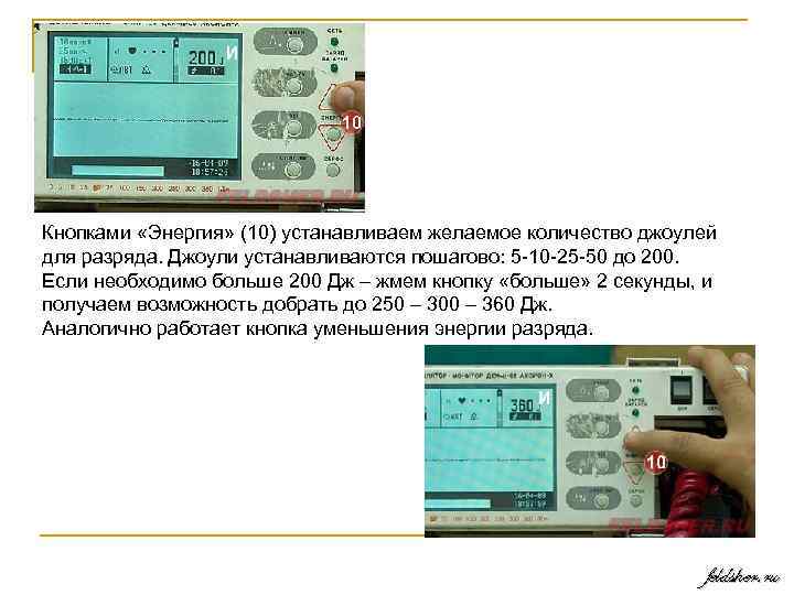 Кнопками «Энергия» (10) устанавливаем желаемое количество джоулей для разряда. Джоули устанавливаются пошагово: 5 10