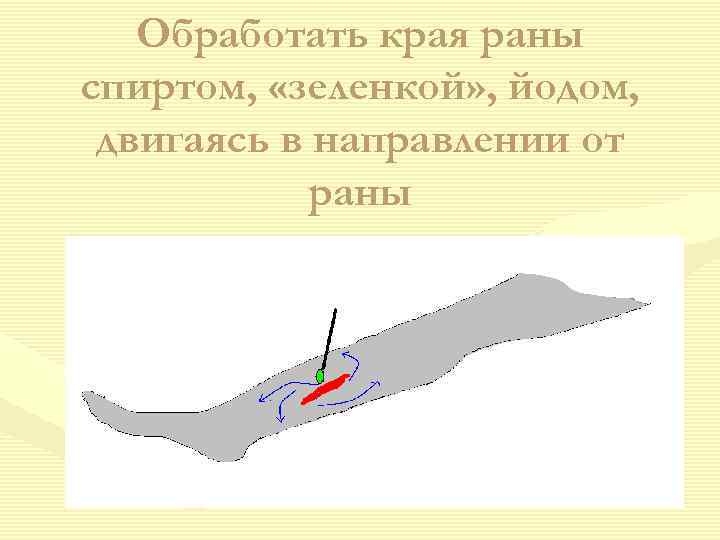 Обработать края раны спиртом, «зеленкой» , йодом, двигаясь в направлении от раны 