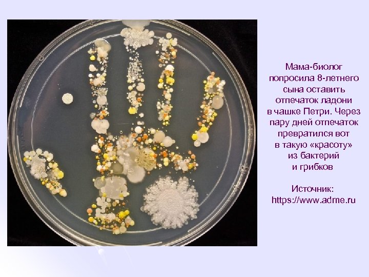 Мама-биолог попросила 8 -летнего сына оставить отпечаток ладони в чашке Петри. Через пару дней
