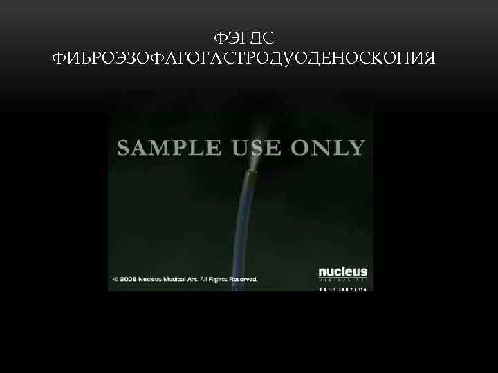 ФЭГДС ФИБРОЭЗОФАГОГАСТРОДУОДЕНОСКОПИЯ 