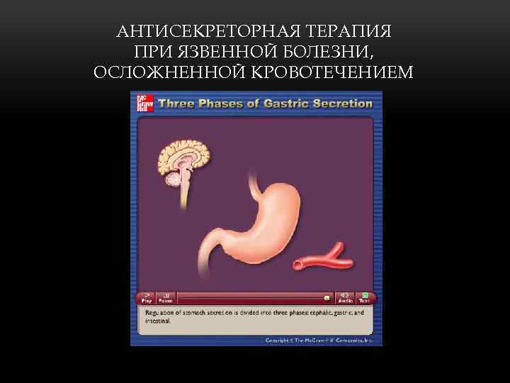 АНТИСЕКРЕТОРНАЯ ТЕРАПИЯ ПРИ ЯЗВЕННОЙ БОЛЕЗНИ, ОСЛОЖНЕННОЙ КРОВОТЕЧЕНИЕМ 
