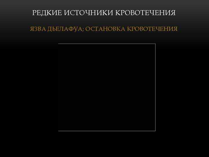 РЕДКИЕ ИСТОЧНИКИ КРОВОТЕЧЕНИЯ ЯЗВА ДЬЕЛАФУА; ОСТАНОВКА КРОВОТЕЧЕНИЯ 