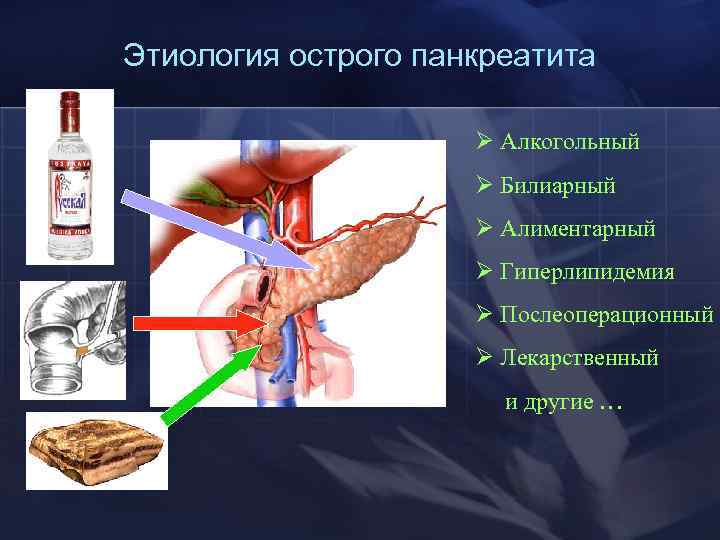 Острый панкреатит. Панкреатит этиология. Этиологические формы острого панкреатита. Острый панкреатит этиология. Остром панкреатите этиология.