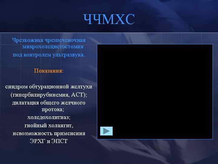 ЧЧМХС Чрезкожная чрезпеченочная микрохолецистостомия под контролем ультразвука. Показания: синдром обтурационной желтухи (гипербилирубинемия, АСТ); дилатация