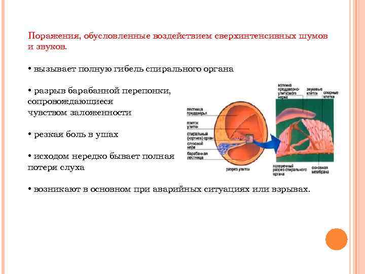Поражения, обусловленные воздействием сверхинтенсивных шумов и звуков. • вызывает полную гибель спирального органа •
