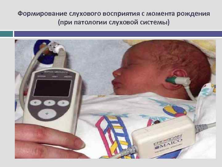 Формирование слухового восприятия с момента рождения (при патологии слуховой системы) 