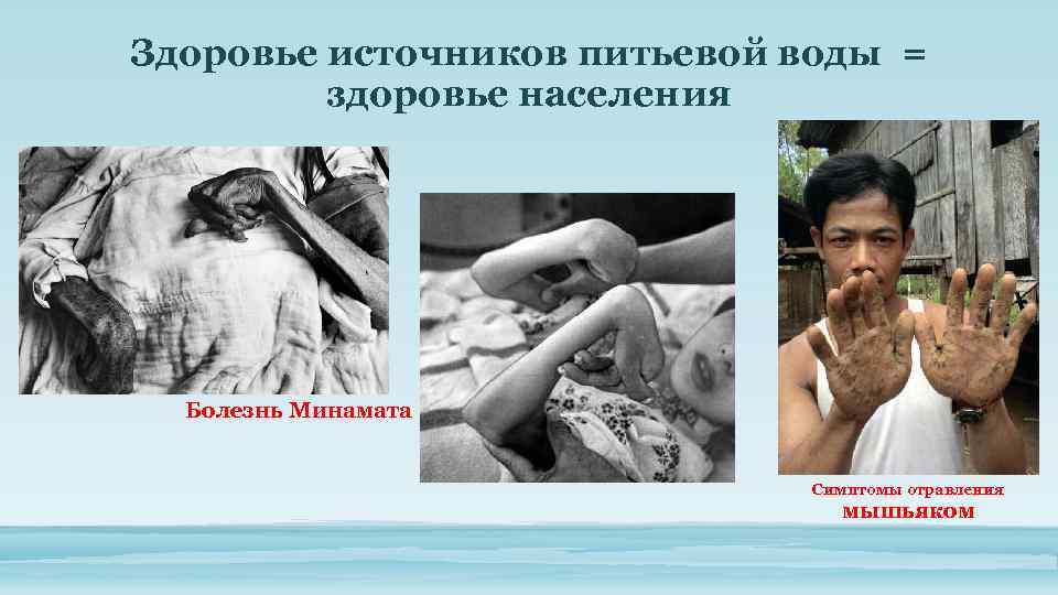 Здоровье источников питьевой воды = здоровье населения Болезнь Минамата Симптомы отравления мышьяком 