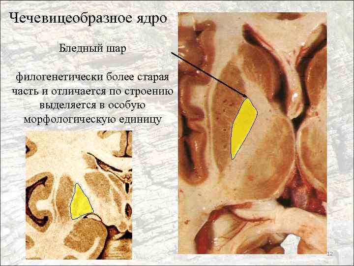 Чечевицеобразное ядро Бледный шар филогенетически более старая часть и отличается по строению выделяется в