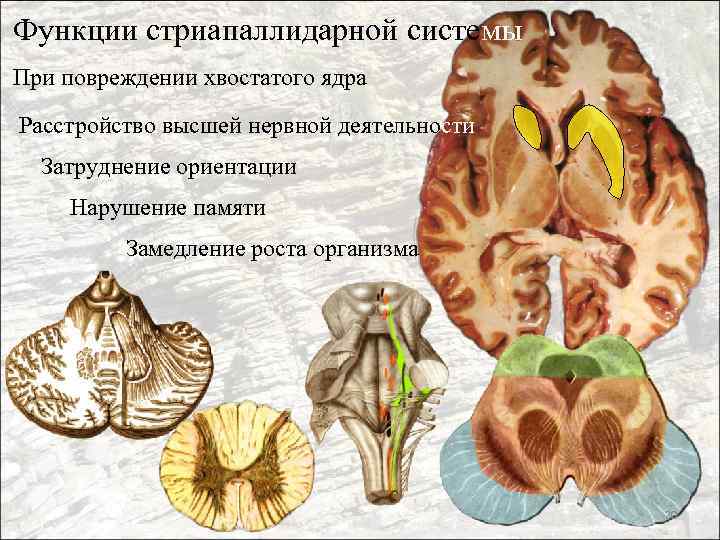 Функции стриапаллидарной системы При повреждении хвостатого ядра Расстройство высшей нервной деятельности Затруднение ориентации Нарушение