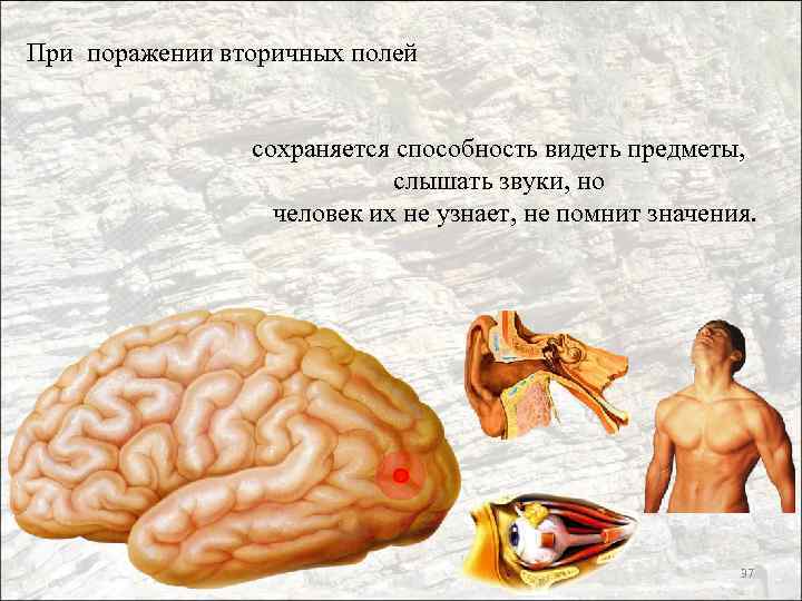 При поражении вторичных полей сохраняется способность видеть предметы, слышать звуки, но человек их не