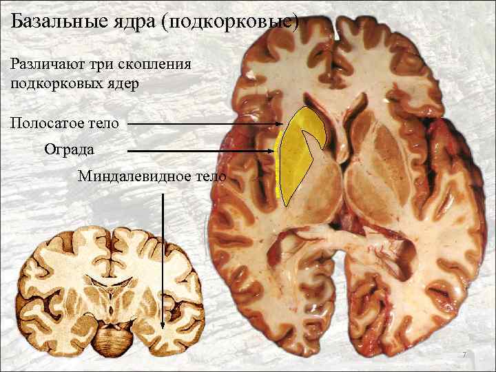 Базальные ядра (подкорковые) Различают три скопления подкорковых ядер Полосатое тело Ограда Миндалевидное тело 7