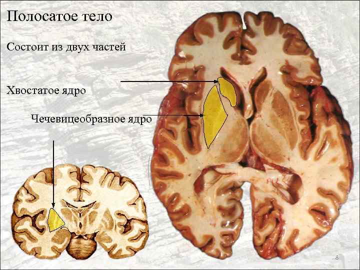 Полосатое тело Состоит из двух частей Хвостатое ядро Чечевицеобразное ядро 8 