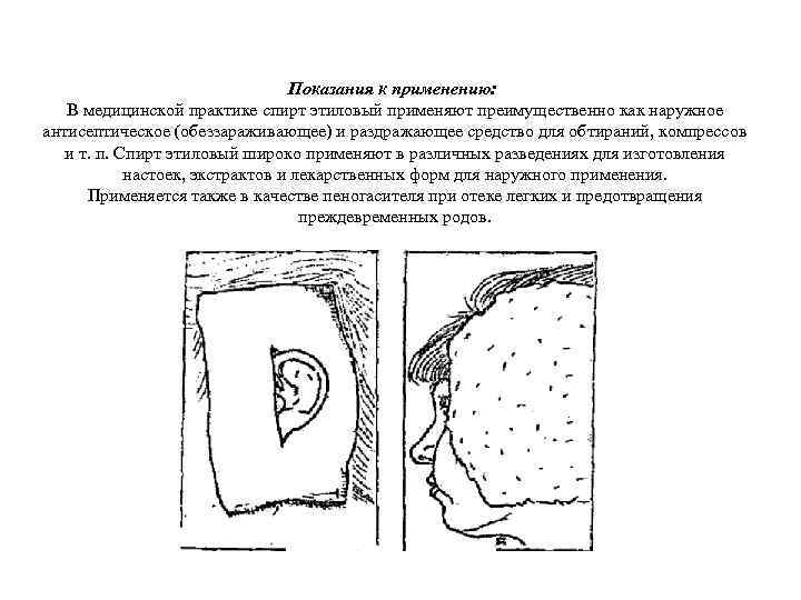 Показания к применению: В медицинской практике спирт этиловый применяют преимущественно как наружное антисептическое (обеззараживающее)