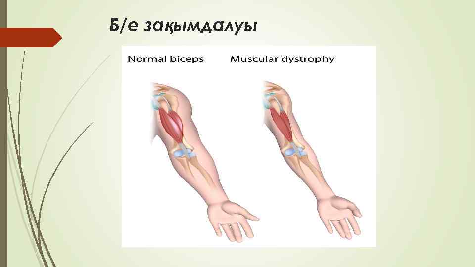 Б/е зақымдалуы 