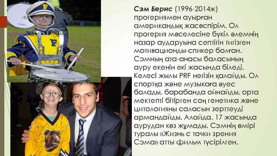 Сэм Бернс (1996 -2014 ж) прогериямен ауырған американдық жасөспірім. Ол прогерия мәселесіне бүкіл әлемнің