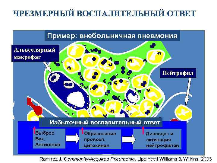 ЧРЕЗМЕРНЫЙ ВОСПАЛИТЕЛЬНЫЙ ОТВЕТ Пример: внебольничная пневмония Альвеолярный макрофаг Нейтрофил Избыточный воспалительный ответ Выброс Бак.