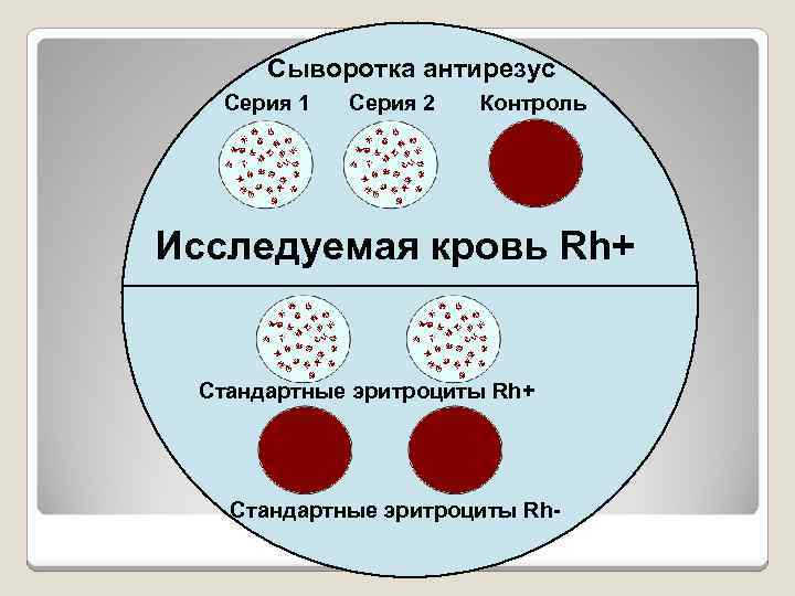 Сыворотка антирезус Серия 1 Серия 2 Контроль Исследуемая кровь Rh+ Стандартные эритроциты Rh- 