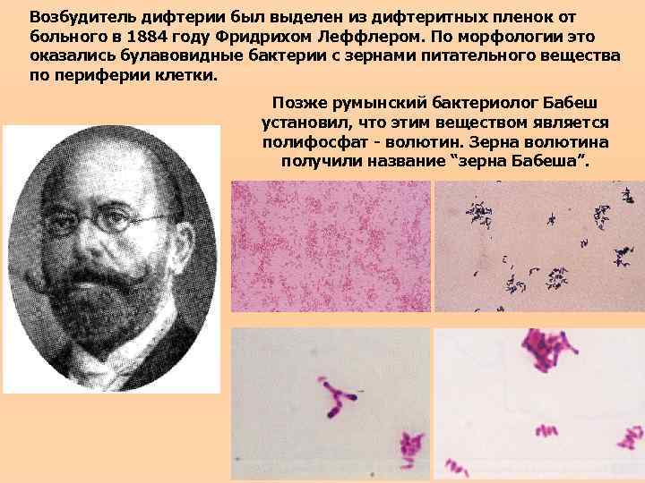Возбудитель дифтерии был выделен из дифтеритных пленок от больного в 1884 году Фридрихом Леффлером.