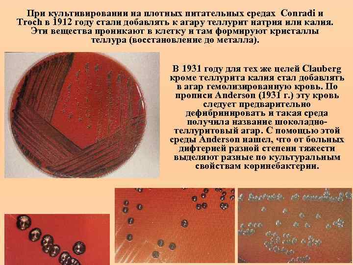 При культивировании на плотных питательных средах Conradi и Troch в 1912 году стали добавлять
