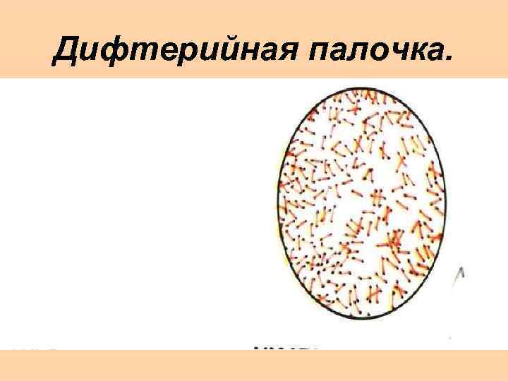 Дифтерийная палочка. 