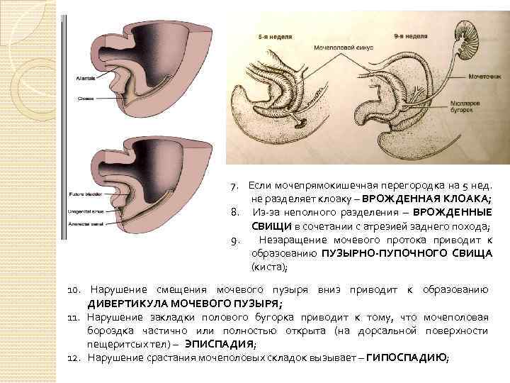 7. Если мочепрямокишечная перегородка на 5 нед. не разделяет клоаку – ВРОЖДЕННАЯ КЛОАКА; 8.