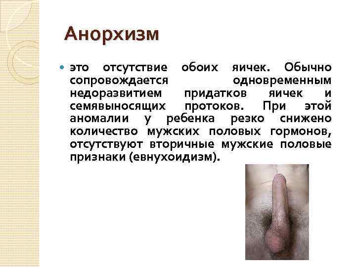  Анорхизм это отсутствие обоих яичек. Обычно сопровождается одновременным недоразвитием придатков яичек и семявыносящих